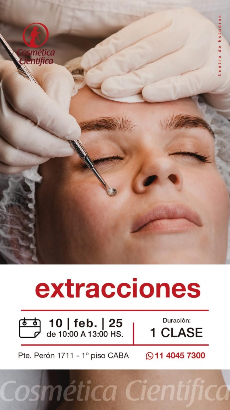 Extracciones