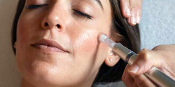 MESOTERAPIA SIN AGUJAS