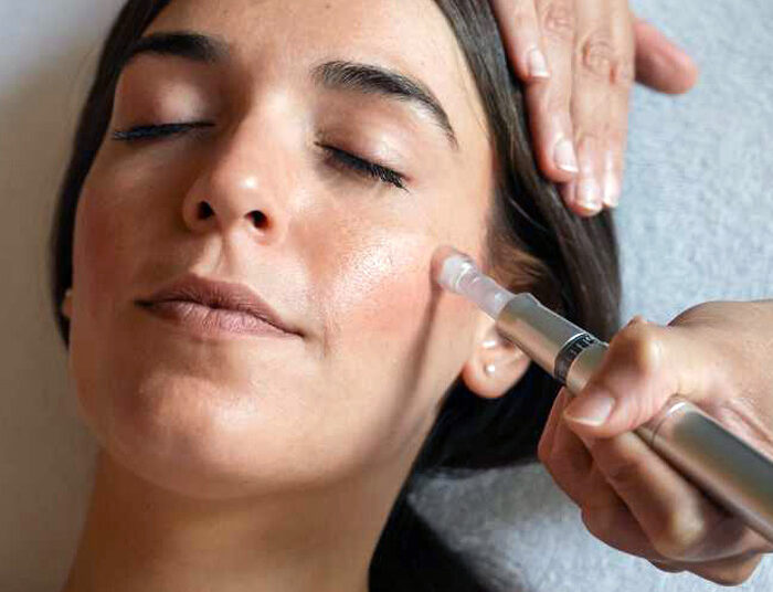 MESOTERAPIA SIN AGUJAS