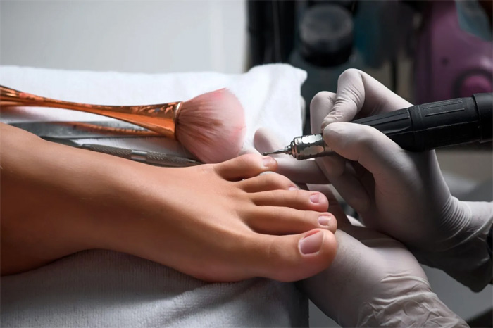 MESOTERAPIA SIN AGUJAS