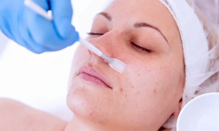 PEELING ENZIMATICO