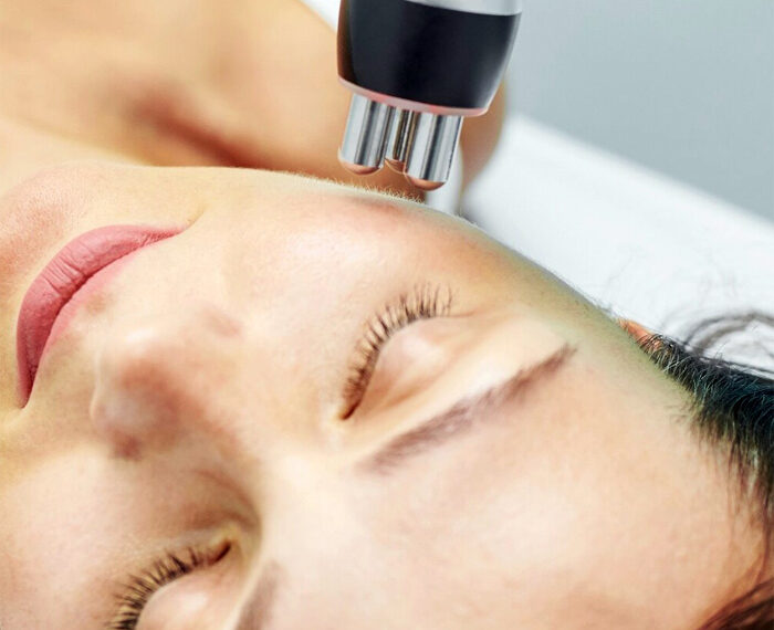 RADIOFRECUENCIA EN ESTETICA