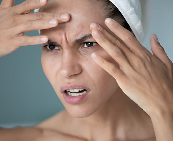 Renovación y desintoxicación de la piel con stress