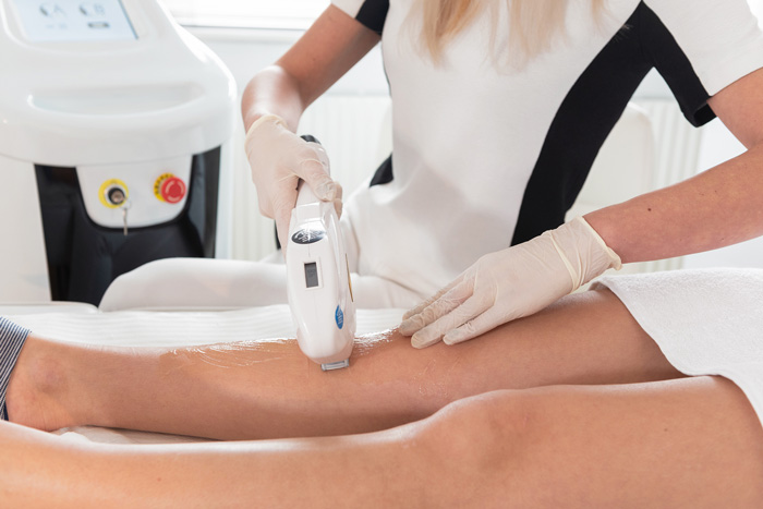 SHR: Tecnología Super Hair Removal