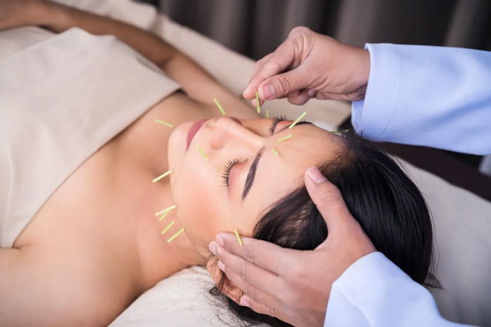 ACUPUNTURA ANTIAGE