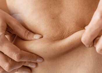 Tratamiento de lipodisolución con fosfatidilcolina para eliminar la adiposidad localizada