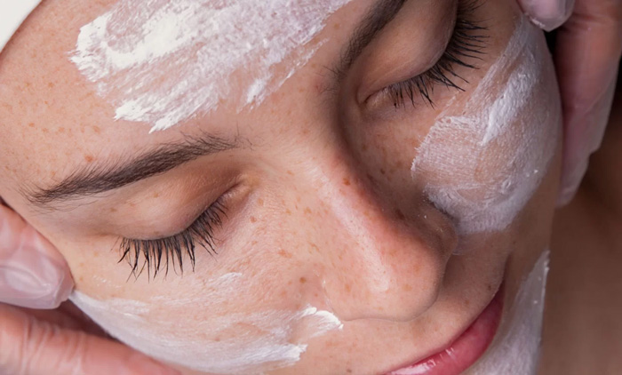 PEELING