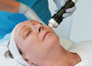 Radiofrecuencia fraccionada: tecnología para la estimulación de colágeno y el tensado cutáneo