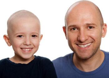 La atriquia congénita