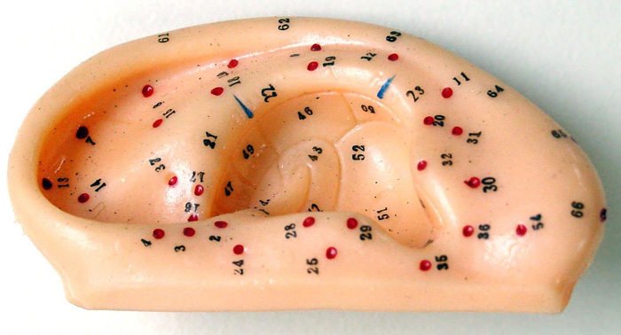 Auriculoterapia