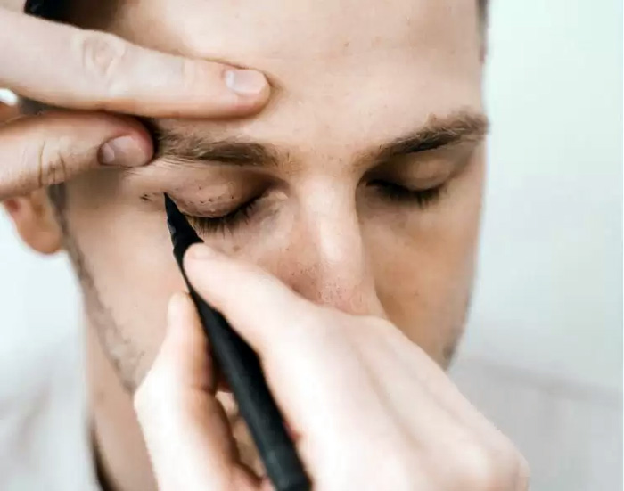 BLEFAROPLASTIA