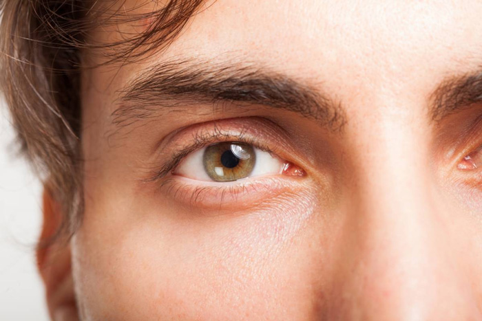 BLEFAROPLASTIA