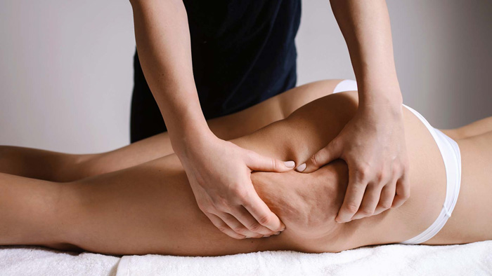 CELULITIS