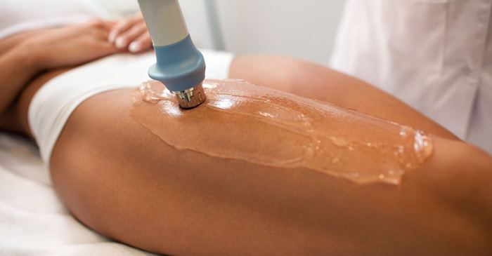 CELULITIS