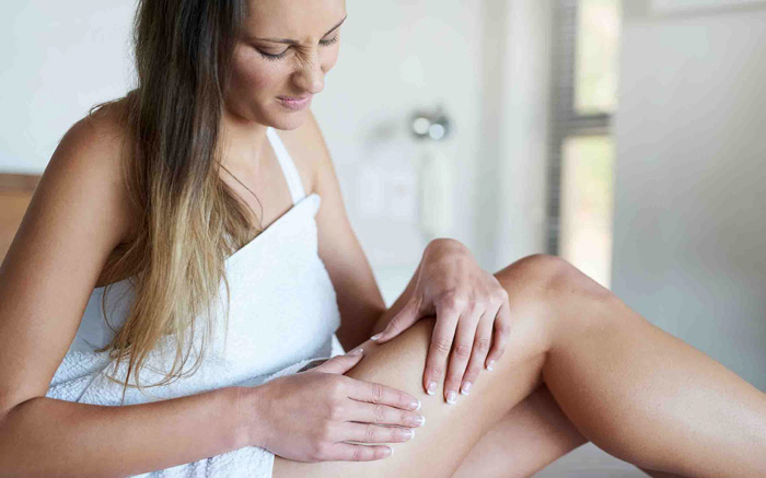 CELULITIS