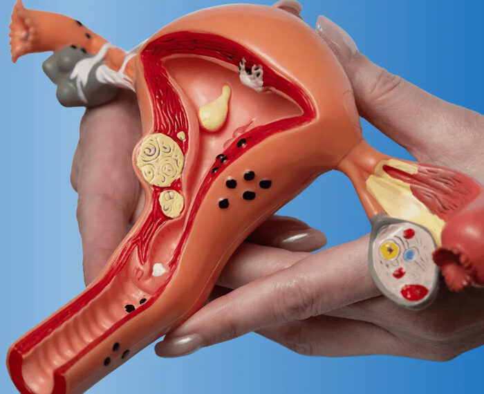 Cirugía de la intimidad