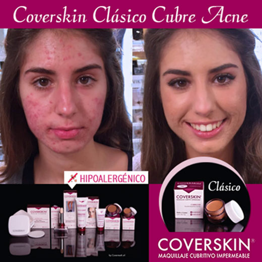 COVERSKIN
