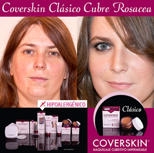COVERSKIN