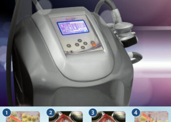 Nuevo VelaSlim Plus: cuatro tecnologías combinadas para tratar la piel de naranja