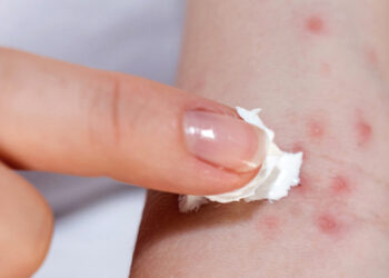 Las erupciones cutáneas