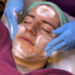 LIMPIEZA FACIAL