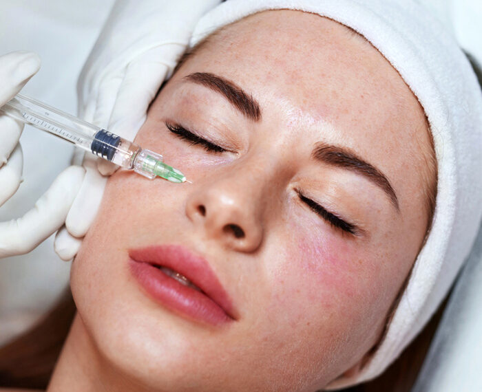 Mesoplastia facial, una técnica de rejuvenecimiento sin cirugía