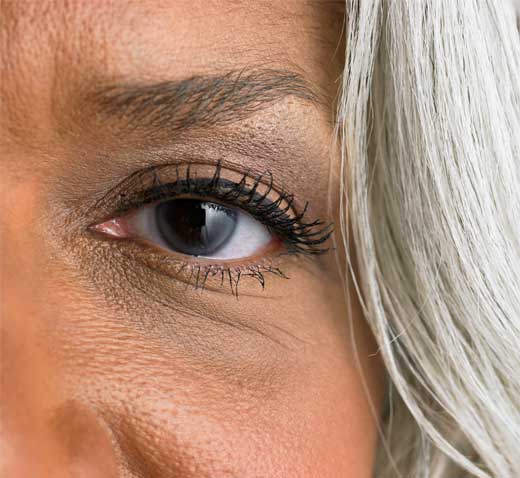 OJERAS