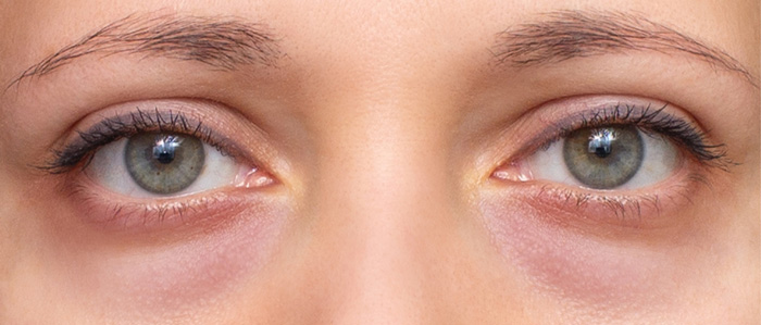 OJERAS