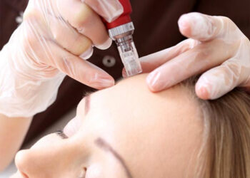 Aplicaciones y beneficios de la mesoterapia con peptonas