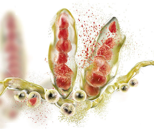 HONGOS EN EL CABELLO