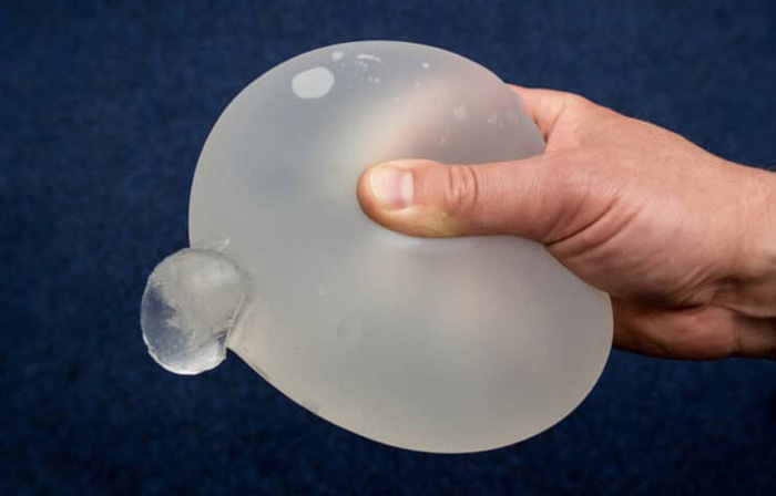 Implantes mamarios de gel de silicona: información de seguridad