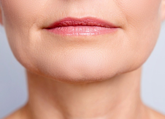 LABIOS