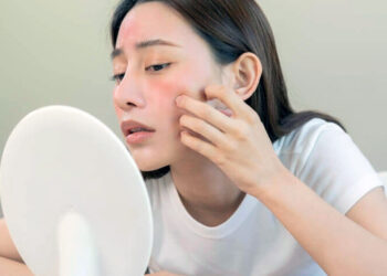 Maquillaje y reacciones en la piel