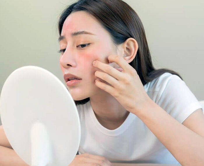 Maquillaje y reacciones en la piel