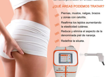 Accustec NG, una nueva generación en ondas radiales