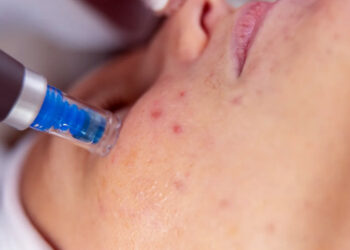 Alteraciones de la pigmentación de la piel