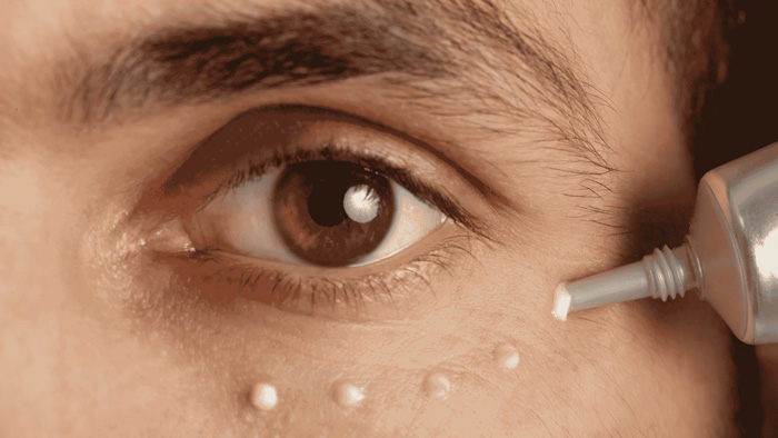 OJERAS
