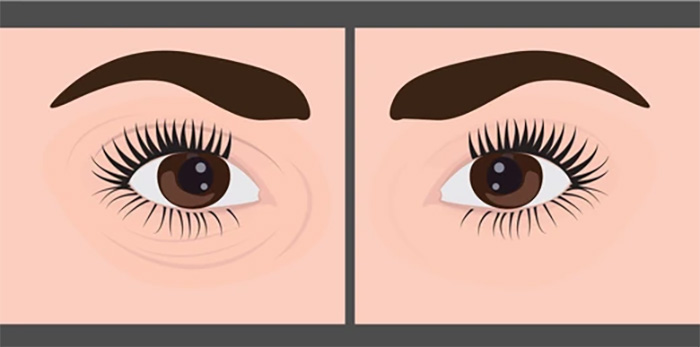 OJERAS