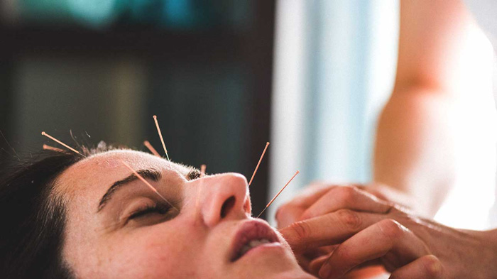 ACUPUNTURA COSMETICA