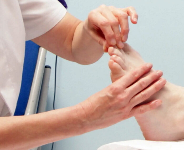 REFLEXOLOGIA Y CANCER