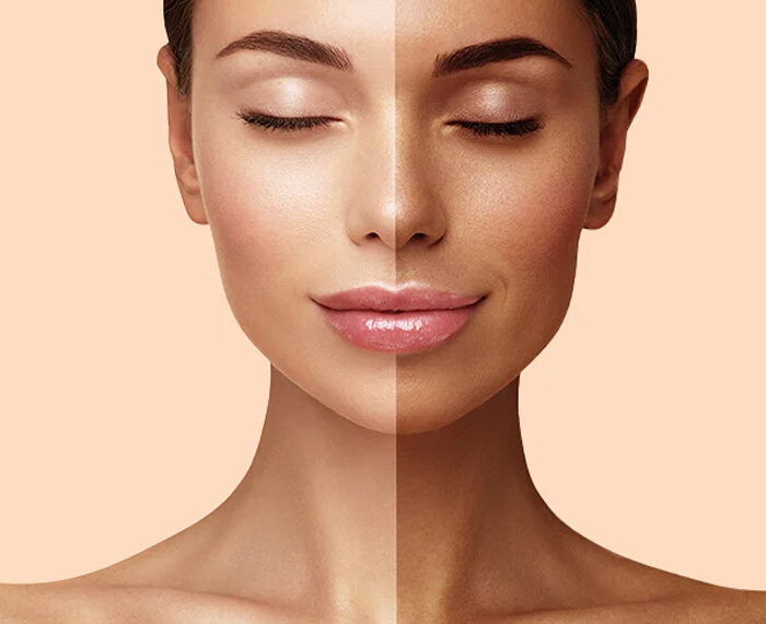 Protocolo: acelerador del bronceado