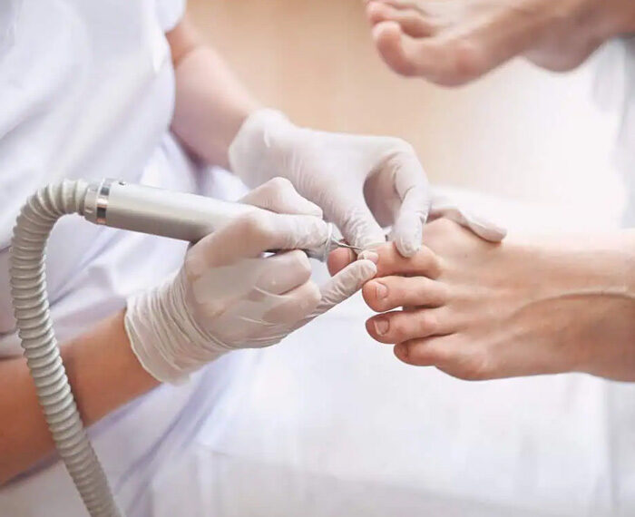 Descamación, estrías, micosis... las diferentes afecciones de las uñas