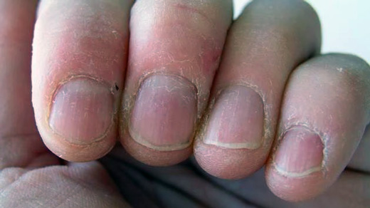 UÑAS Y PIEL