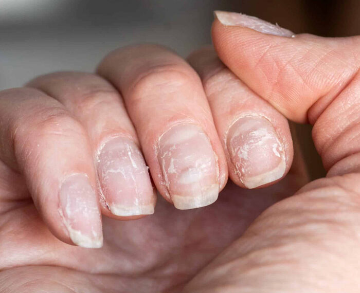 Uñas: siete signos reveladores de trastornos en la salud