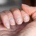 Uñas: siete signos reveladores de trastornos en la salud