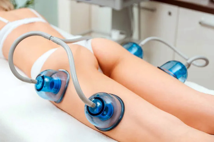 VACUUMTERAPIA