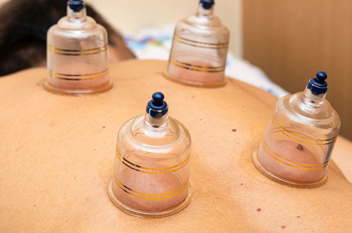 VACUUMTERAPIA