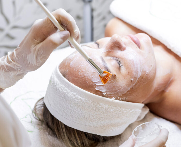 PEELING LIDHERMA